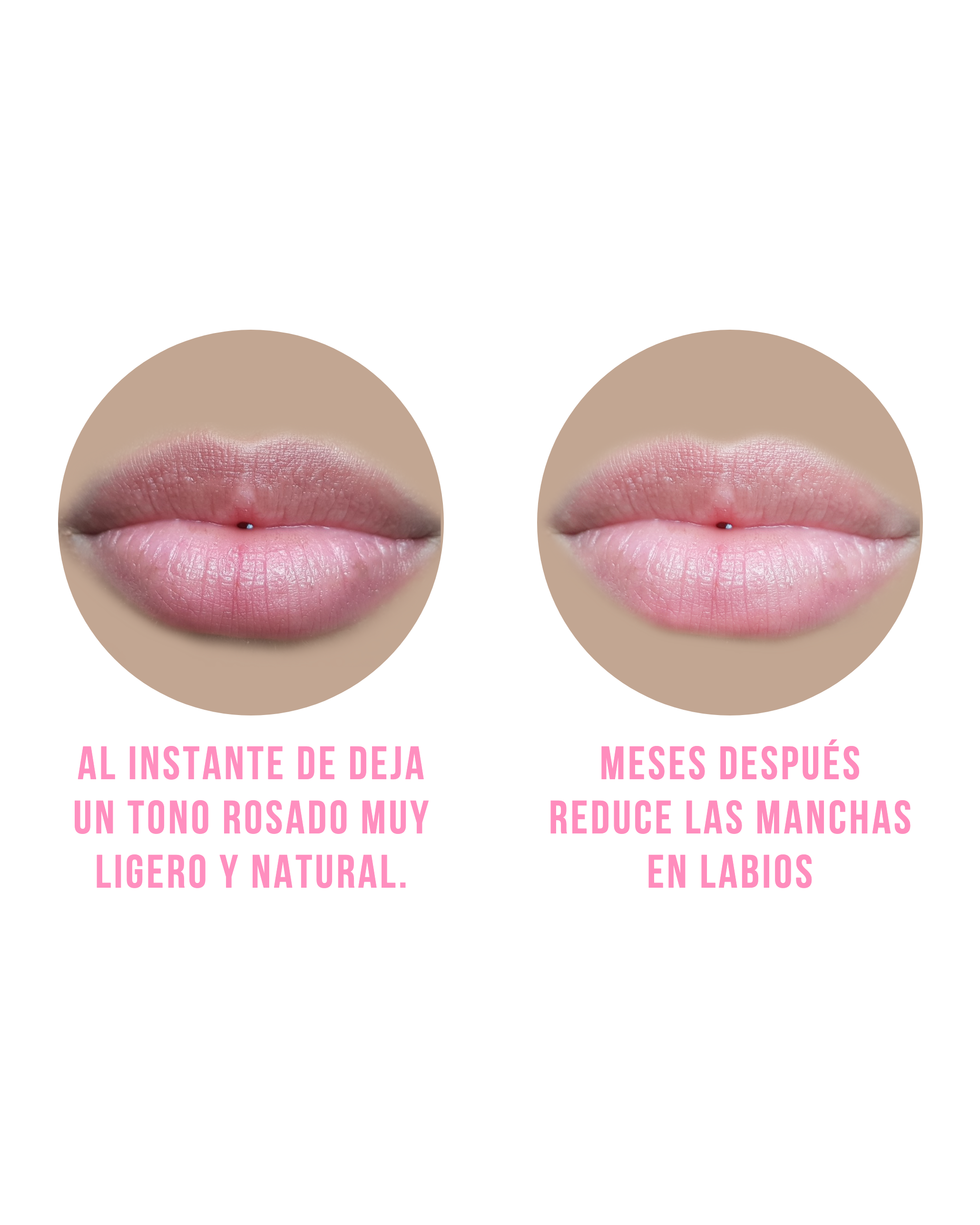 Tea Box | Big Gold Lip - Il'argento