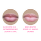 Lip-X